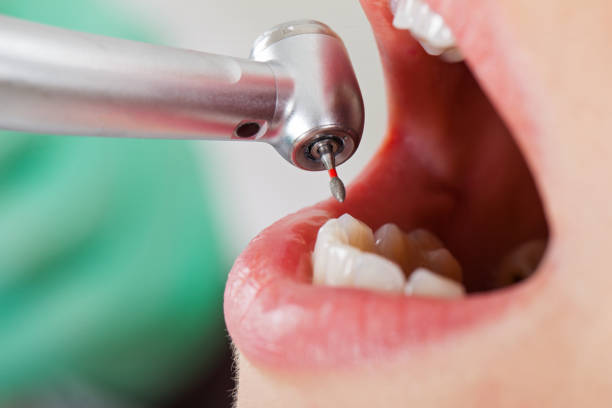 Best Pediatric Emergency Dentist in Pojoaque, NM
